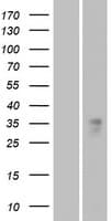 Human OR1B1 Protein (Over-Expression Lysate Myc-DDK (Flag))
