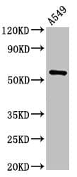 TRIM21 / RO52 Antibody
