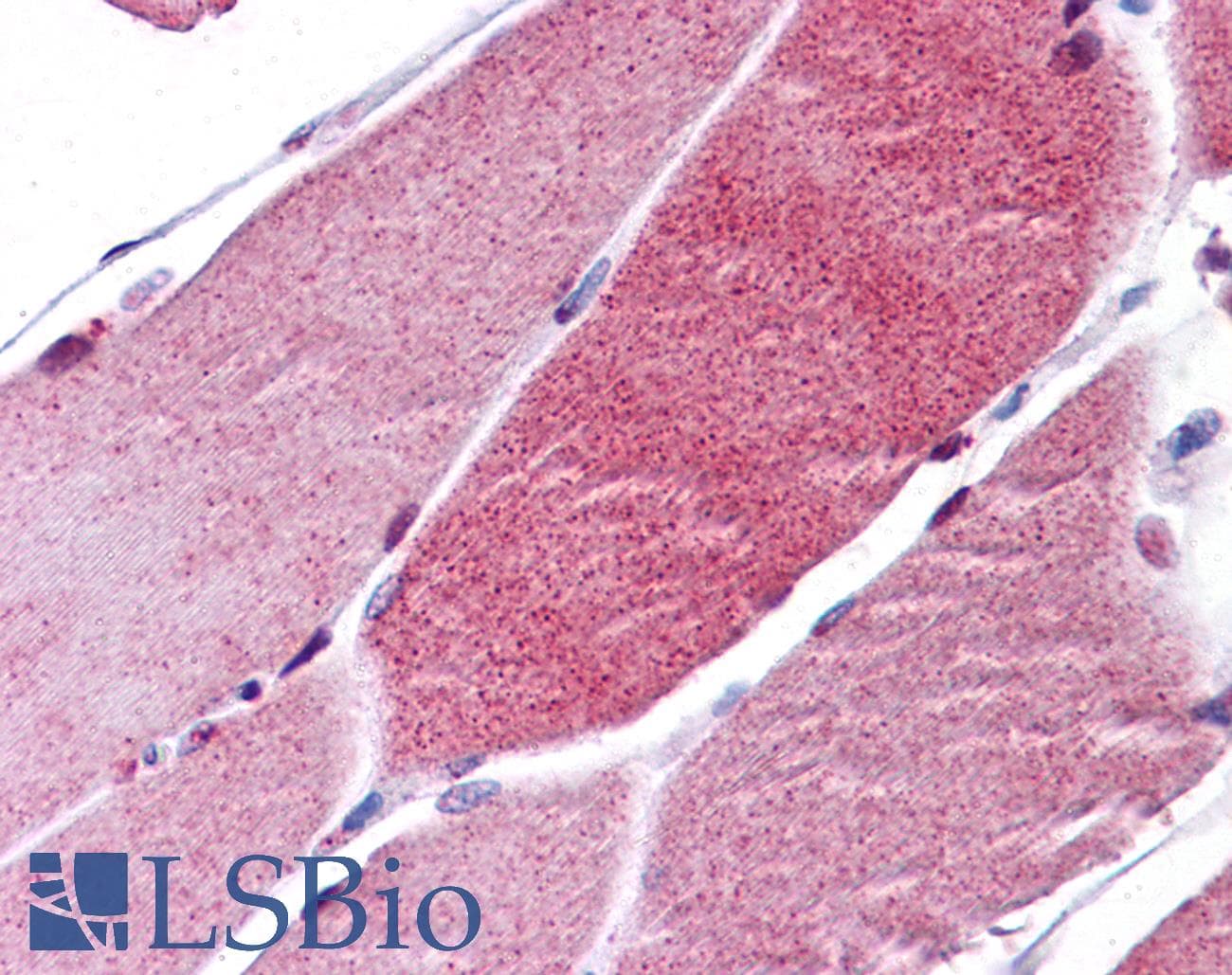 IHC-plus™ Polyclonal Rabbit anti-Human FOXO3 / FOXO3A Antibody (IHC, IF, WB)