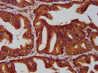 EVC2 Antibody