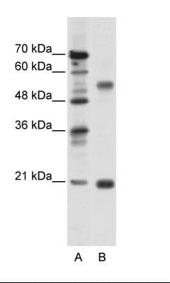 CHRNB3 Antibody (aa176-225)
