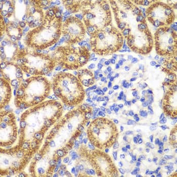 Polyclonal Rabbit anti-Human UGDH / UDPGDH Antibody (IHC, IF, WB)
