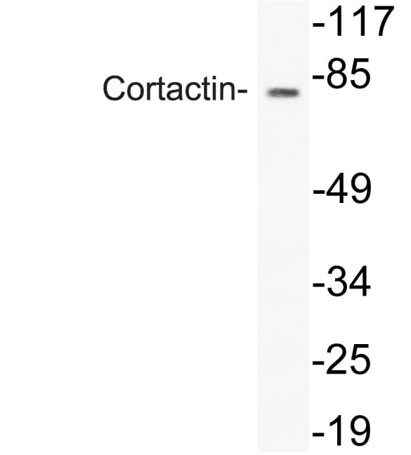 CTTN / Cortactin Antibody (aa391-440)