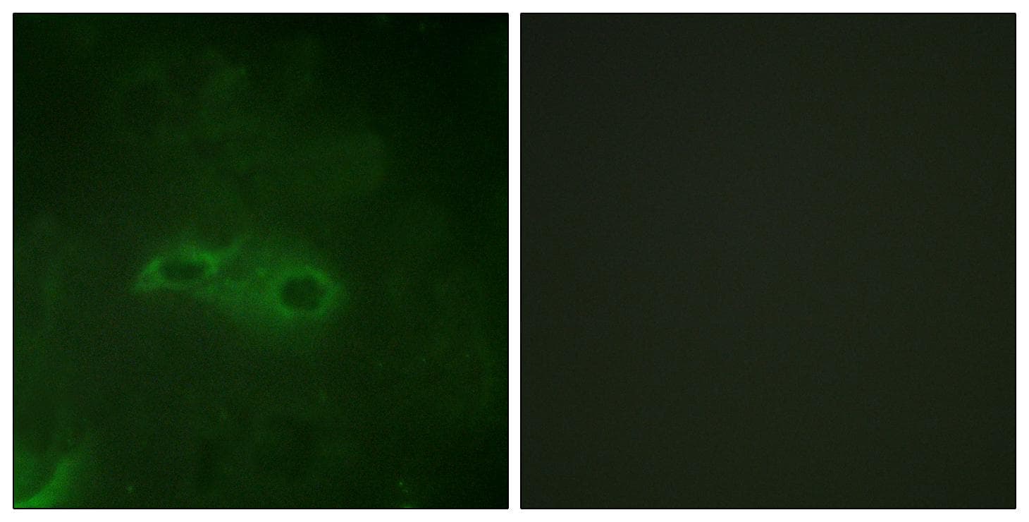 TGFBR1 / ALK5 Antibody (phospho-Ser165)