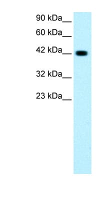 Polyclonal Rabbit anti-Human GATA3 Antibody (aa364-413, IHC, WB)