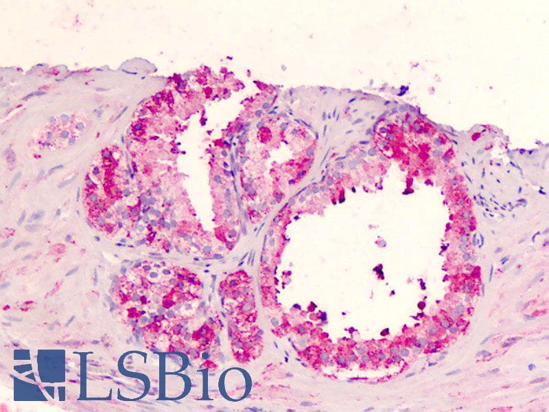 PathPlus™ Polyclonal Rabbit anti-Human GPR183 / EBI2 Antibody (Extracellular Domain, IHC)