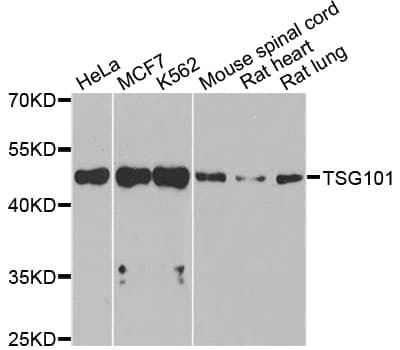 Polyclonal Rabbit anti-Human TSG101 Antibody (IHC, WB)