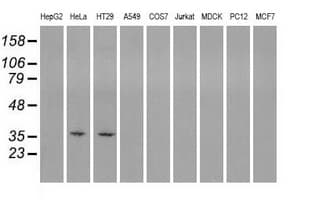 SORD / Sorbitol Dehydrogenase Antibody (clone OTI2A10)