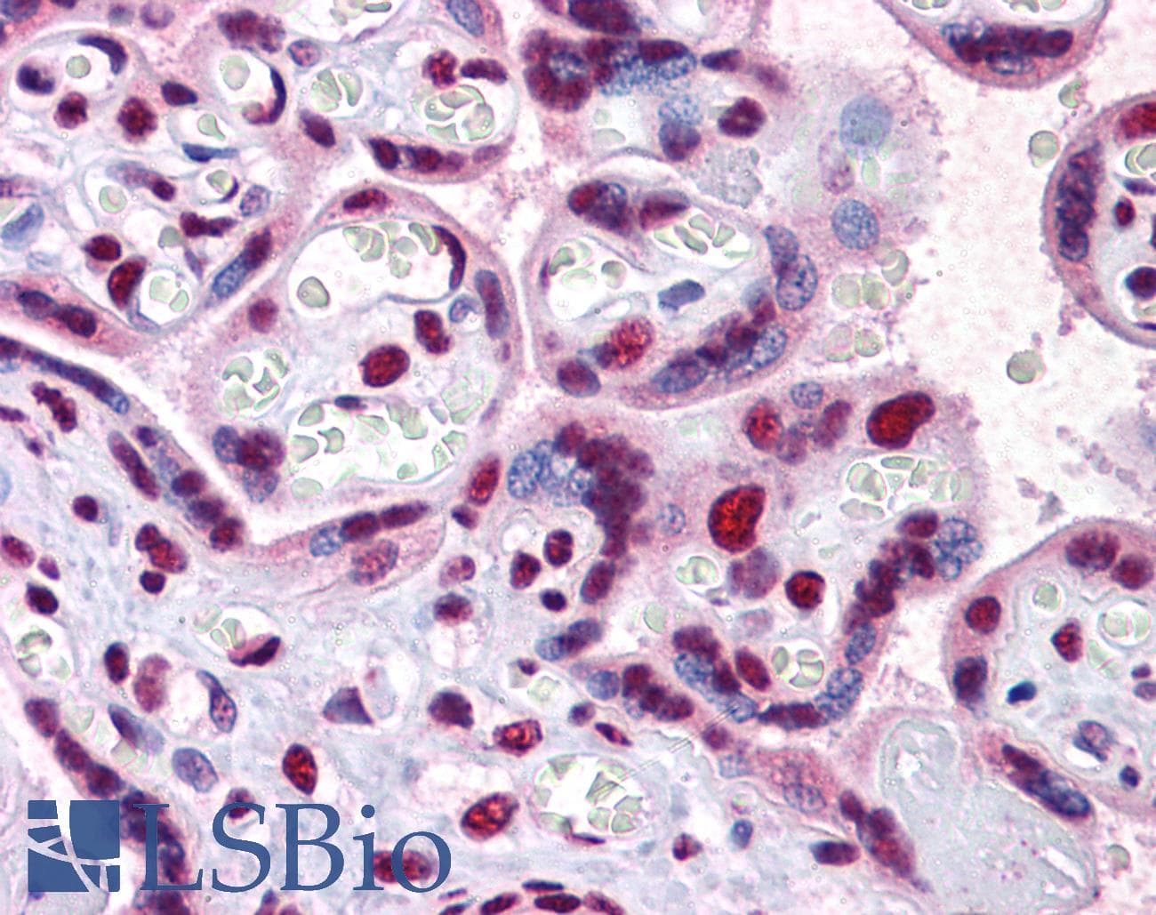 IHC-plus™ SCML1 Antibody (clone 4G3)