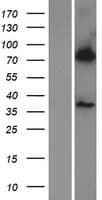 BBS7 Protein (Over-Expression Lysate Myc-DDK (Flag))