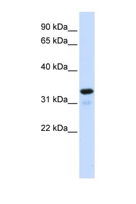 Polyclonal Rabbit anti-Human NFKBIA / IKB Alpha / IKBA Antibody (C-Terminus, WB)