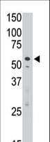 Polyclonal Rabbit anti-Human SIGLEC7 / CD328 Antibody (aa407-438, IHC, WB)