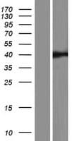 RASSF6 Protein (Over-Expression Lysate Myc-DDK (Flag))