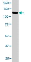 TAOK1 / TAO1 Antibody (clone 4E12)