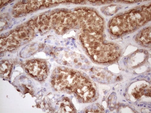 Monoclonal Mouse anti-Human HAVCR2 / TIM-3 Antibody (clone OTI2E2, aa22-202, IHC)