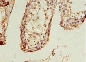 LHCGR / LHR / LH Receptor Antibody (aa27-363)