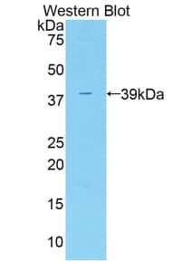 ADAP2 / CENTA2 Antibody (aa49-361)