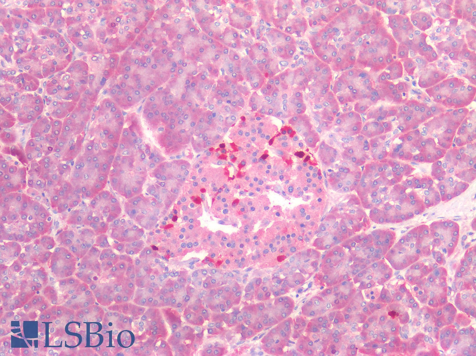 IHC-plus™ MYC / c-Myc Antibody