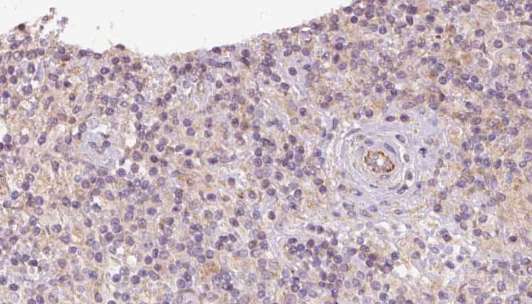 CCDC22 Antibody