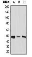 Polyclonal Rabbit anti-Human TFAP2C / AP2 Gamma Antibody (C-Terminus, IHC, WB)