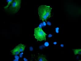 CCM2 / Malcavernin Antibody (clone OTI1E8, Carrier-free)