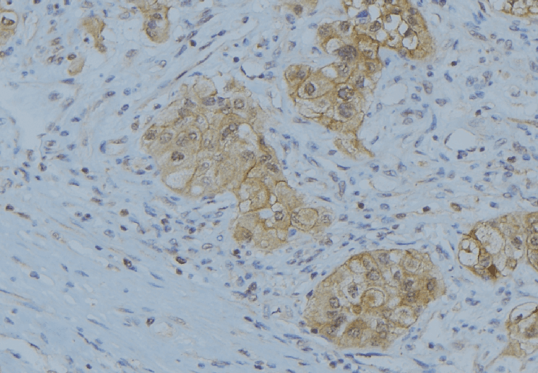 KLK3 / PSA Antibody