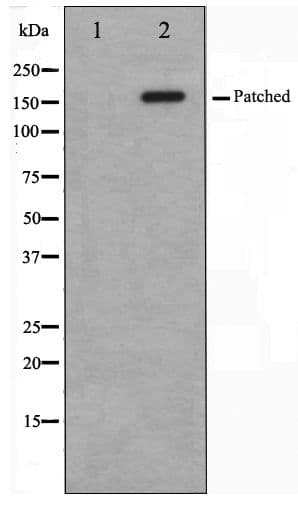 Polyclonal Rabbit anti-Human PTCH1 / Patched 1 Antibody (IHC, WB)
