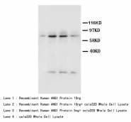 Polyclonal Rabbit anti-Human ANGPT1 / Angiopoietin-1 Antibody (Sepharose, aa278-295)