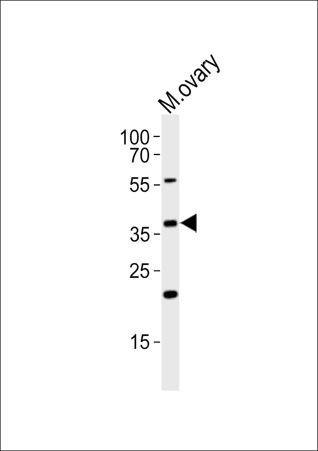 BAF53 / ACTL6A Antibody (aa361-395)