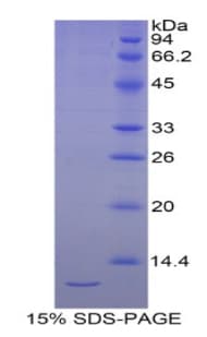Human SEPW1 / Selenoprotein W (Recombinant His)