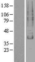 TM9SF1 Protein (Over-Expression Lysate Myc-DDK (Flag))