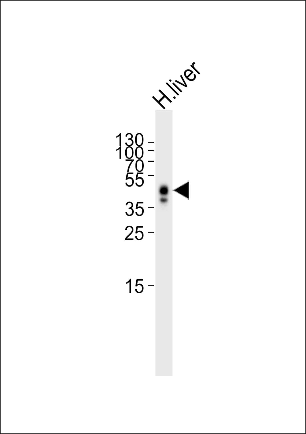 PathPlus™ HP / Haptoglobin Antibody (aa295-322)