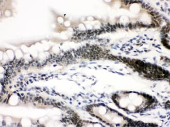 CTCF Antibody