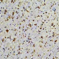 HSP90 Beta Antibody