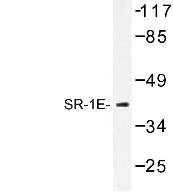Polyclonal Rabbit anti-Human HTR1E / 5-HT1E Receptor Antibody (Ala127, WB)
