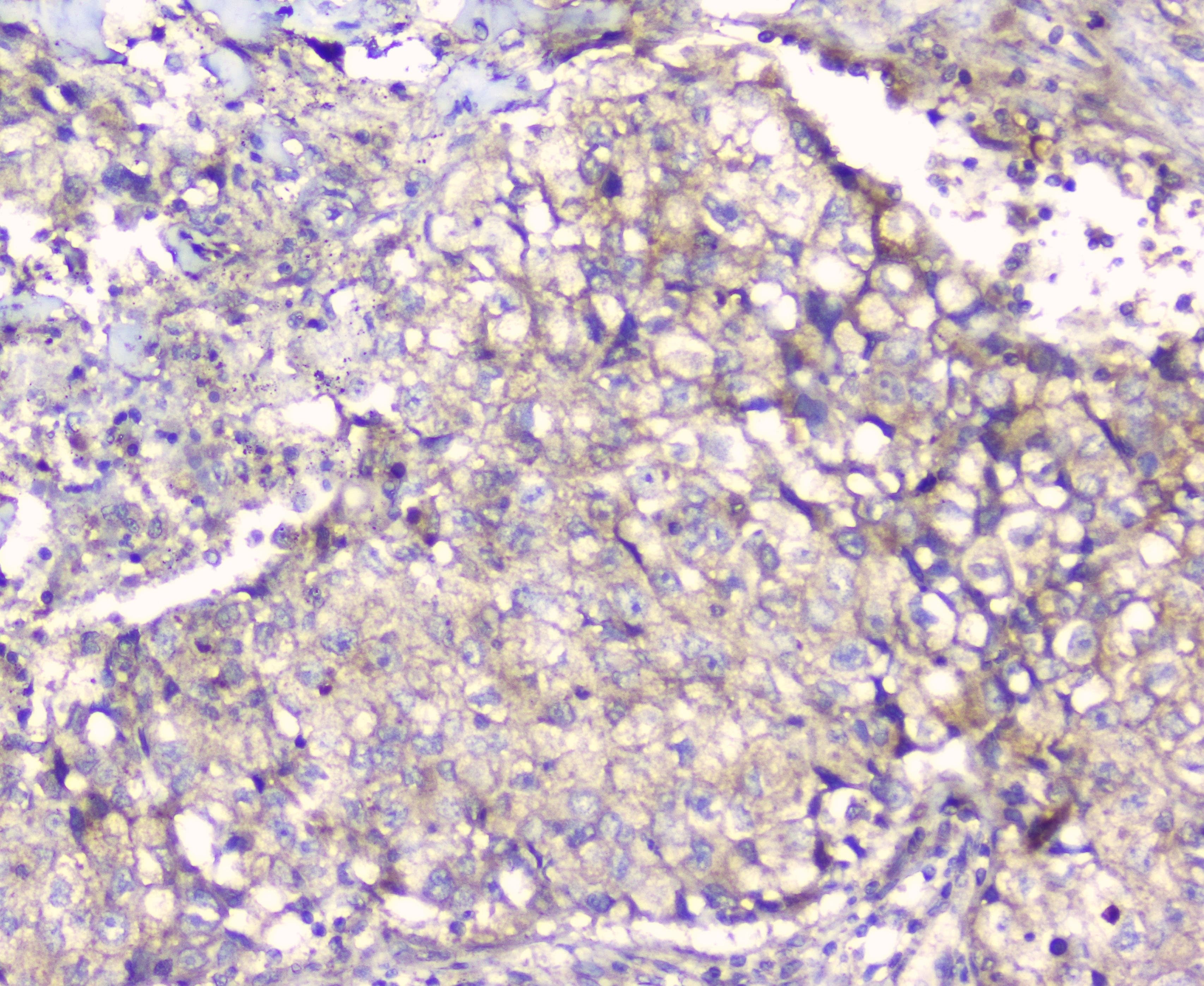PDCD6IP / ALIX Antibody (aa2-330)