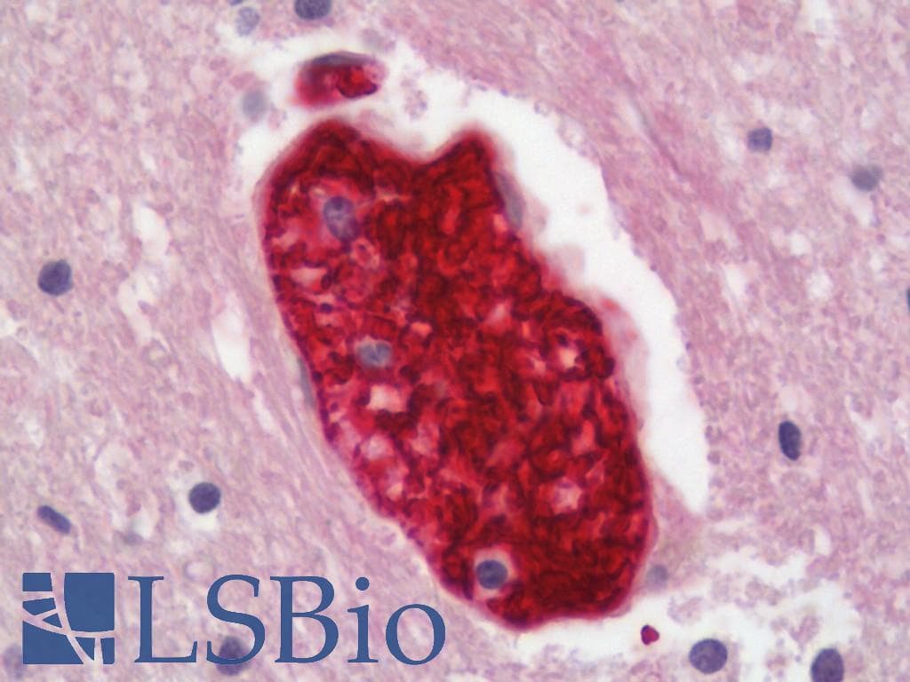 IHC-plus™ Polyclonal Rabbit anti-Human RBC / Red Blood Cells Antibody (IHC)