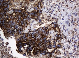 HSPD1 / HSP60 Antibody (clone OTI6F7)