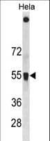 IHC-plus™ SQSTM1 Antibody (aa383-409)