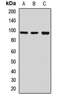 Polyclonal Rabbit anti-Human TRPC3 Antibody (IHC, WB)