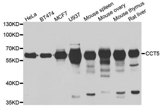 CCT5 / TCP1 Epsilon Antibody