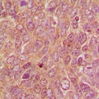 DUSP9 Antibody (Internal)