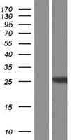 HDHD1 Protein (Over-Expression Lysate Myc-DDK (Flag))