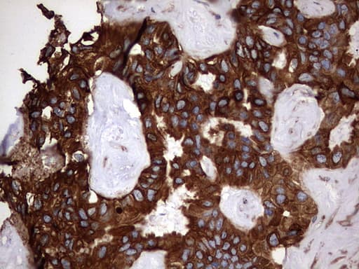 KRT7 / CK7 / Cytokeratin 7 Antibody (clone OTI2A2)