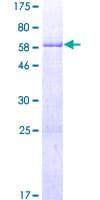 Human CLVS1 Protein (Recombinant GST)