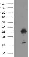 MMACHC Antibody (clone OTI2A6)