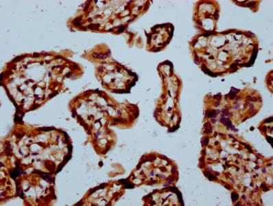 NDUFAF3 Antibody