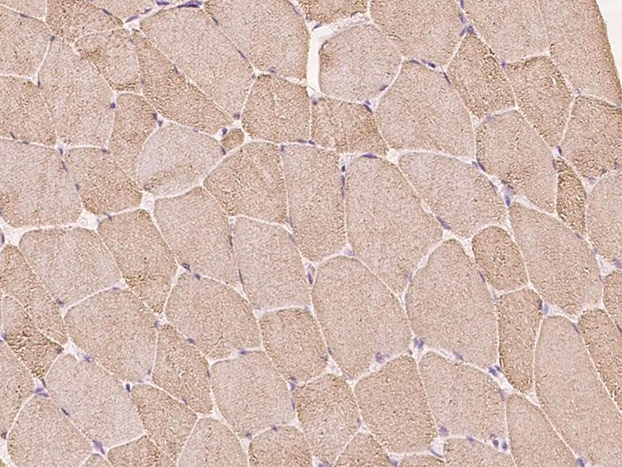 Polyclonal Rabbit anti-Human CASQ1 / Calsequestrin 1 Antibody (Preservative Free, IHC, IF)