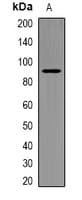 Polyclonal Rabbit anti-Human PIBF1 / PIBF Antibody (IHC, WB)