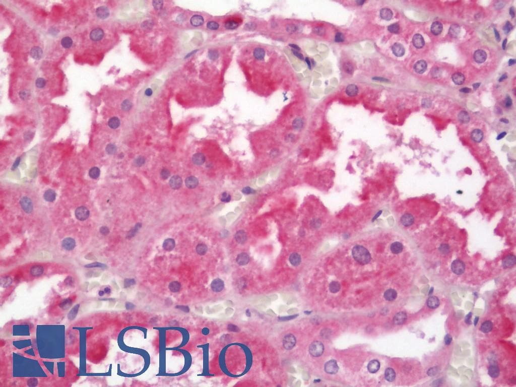 IHC-plus™ RIPK1 / RIP Antibody (aa152-180)